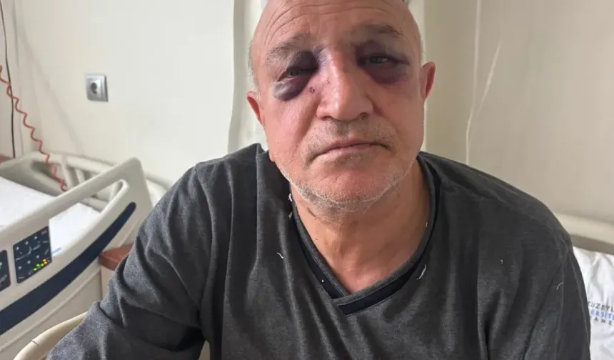 İzmir’de esnaf odası başkanına bıçaklı saldırı: 1 gözaltı