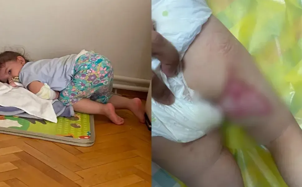 İzmir'de restoranda üzerine kızgın yağ dökülen bebek yandı