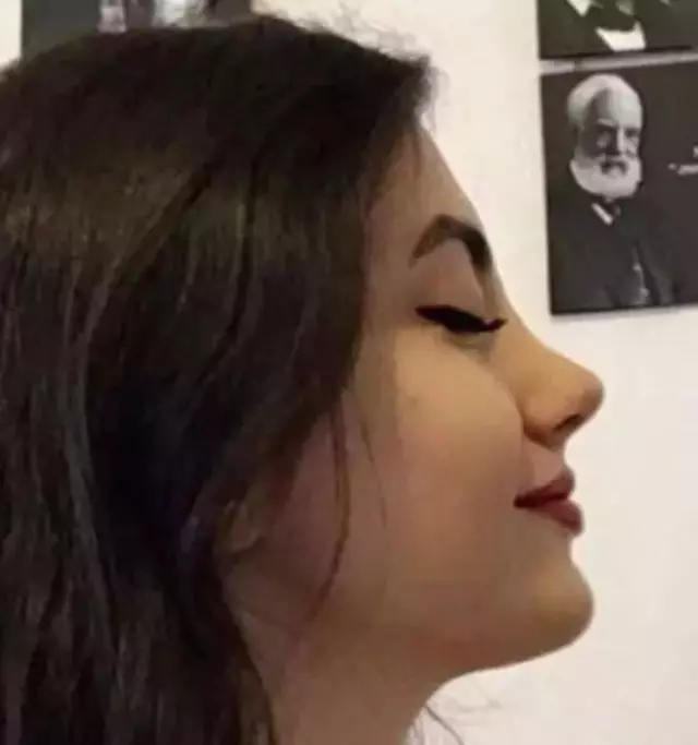 kismetse-olur-elif-nur-yelin-estetiksiz-hali-sosyal-medyayi-salladi3