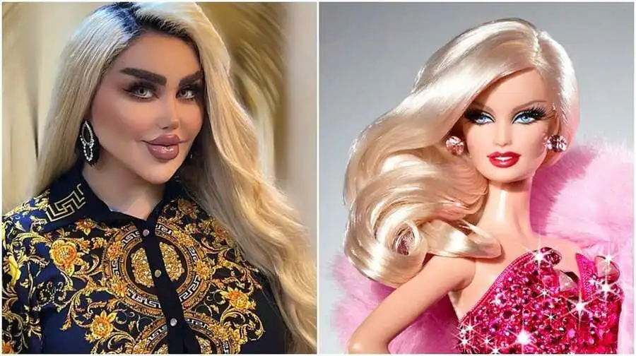 Servetini döktü... Irak'lı kadından şok değişim! Barbie Bebeğe benzemek için '43 operasyon' geçirdi
