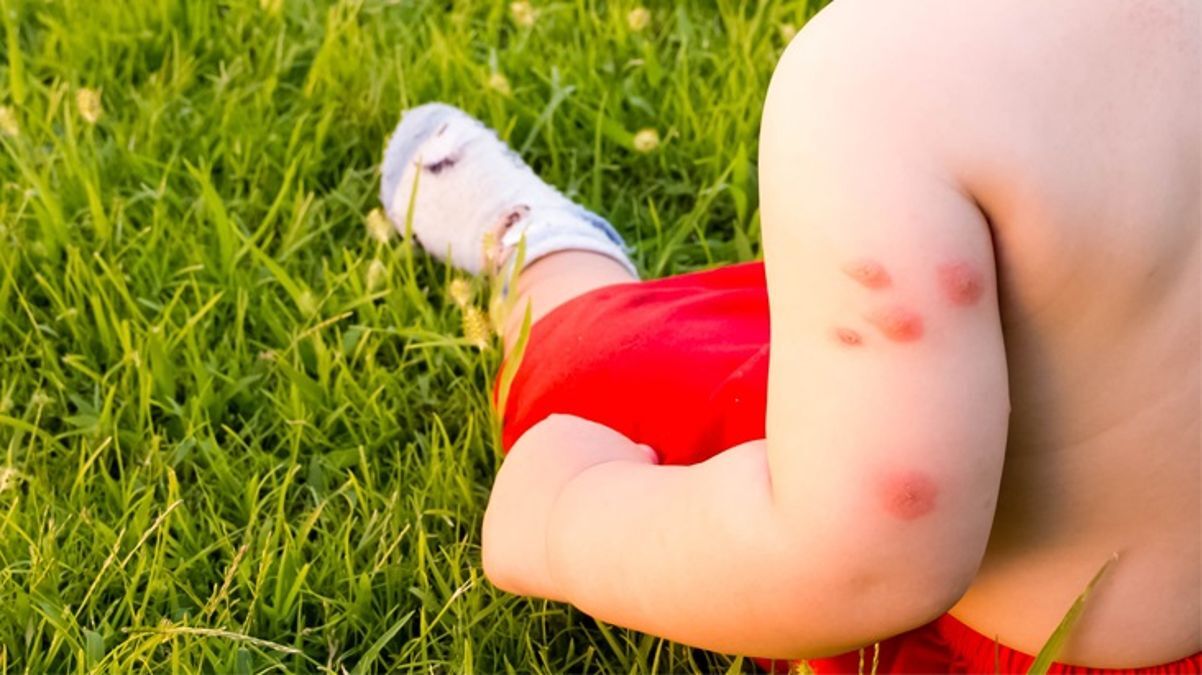 yavru-vatan-kibrista-bati-nil-virusu-vakasi-tespit-edildi