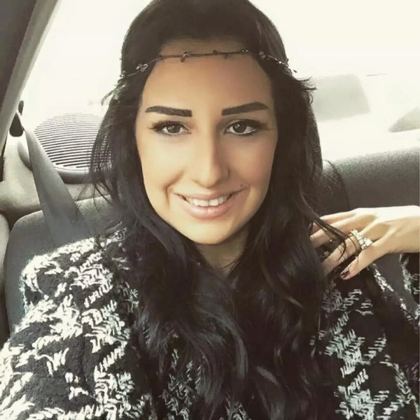 dilan-polatin-estetiksiz-eski-hali-dilan-polat-eskiden-ne-is-yapiyordu-dilan-polat-meslegi-ne