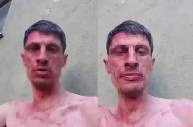 Sosyal Medyada Kan Donduran Anlar Cesareti Olmayan Izlemesin Dedi Enistesini Bicakladi 3