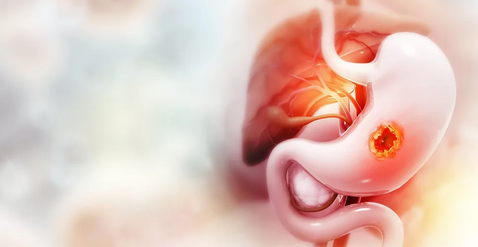 Gastrit Ve Reflusu Olanlar Ne Yemeli Reflu Hastalari Kahvaltida Ne Yemeli (2)