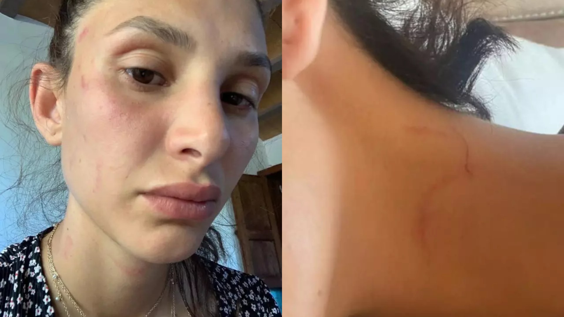 Sara Bluma Siddet Gördü