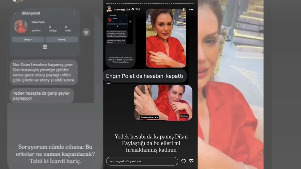 Dilan Polatin Ellerine Ne Oldu Cizikler Ne Anlama Geliyor