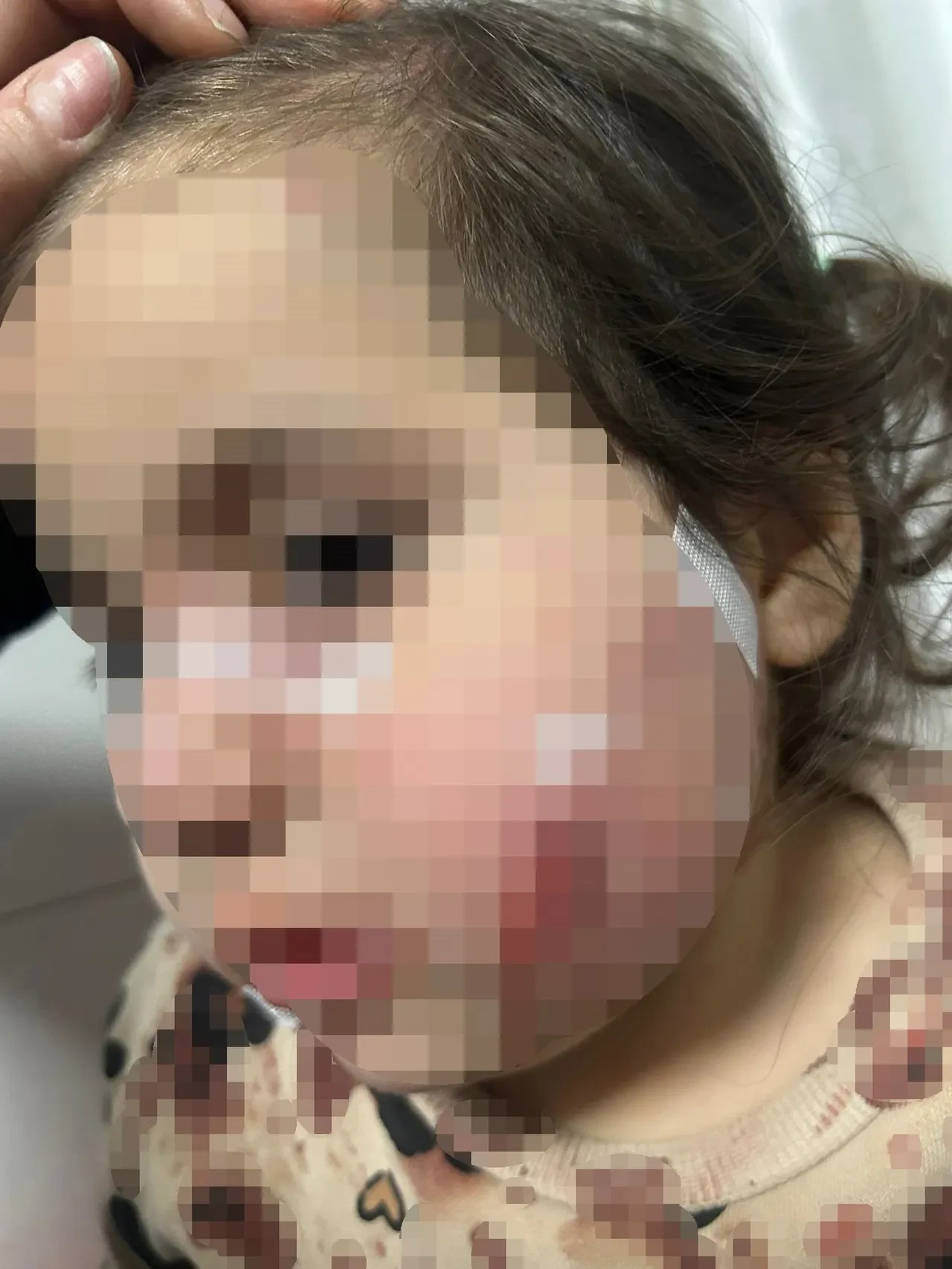 Izmirde 3 Yasindaki Cocuk Kopek Saldirisinda Yaralandi (1)