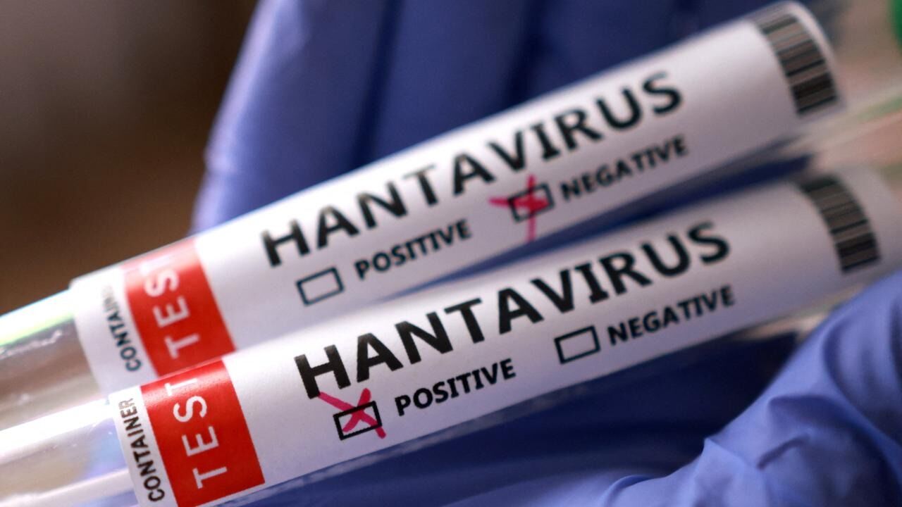 Hantavirus Turkiye Icin Risk Mi Uzmanlar Yeni Pandemi Tehdidi Hakkinda Uyariyor (2)