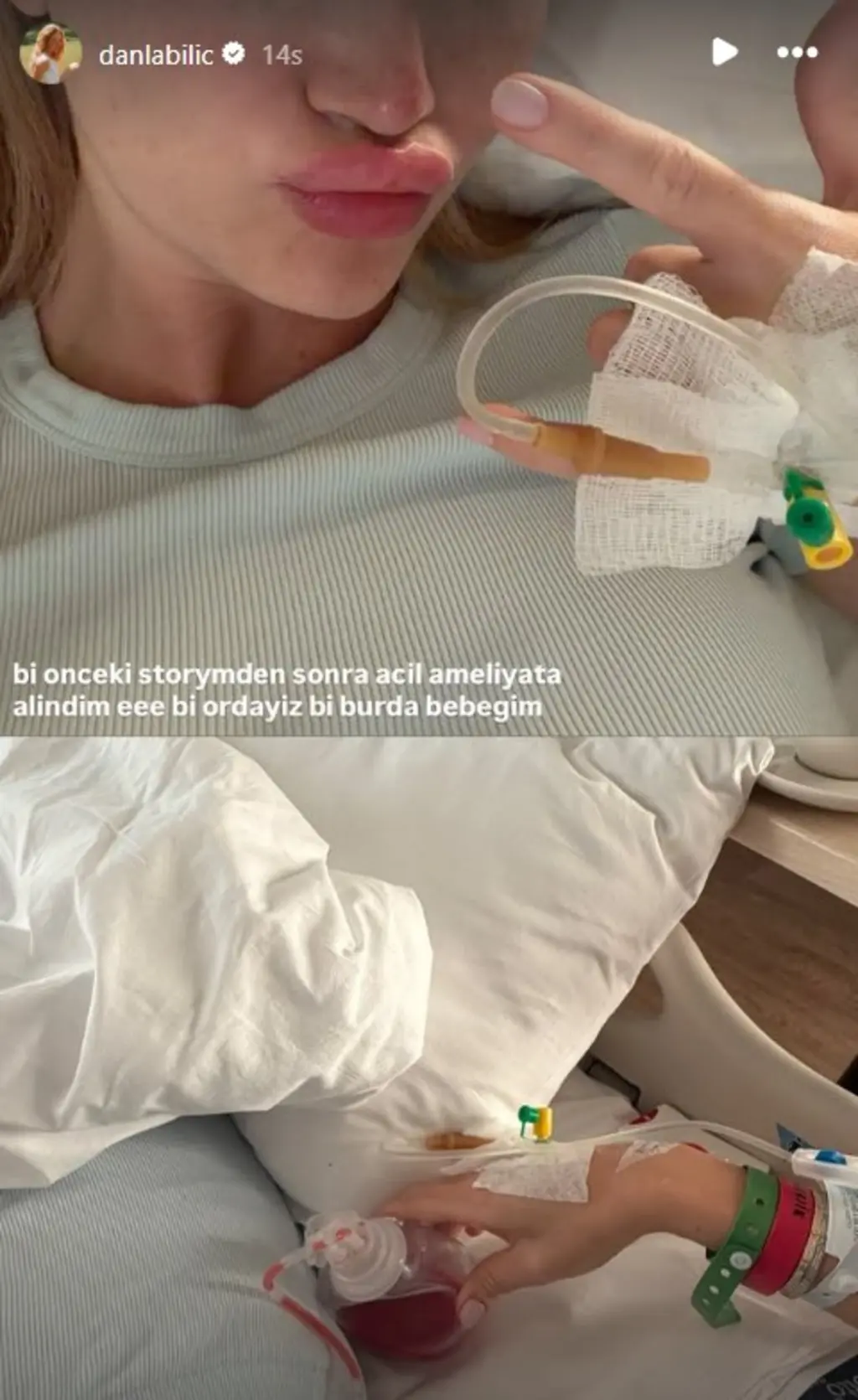 Danla Bilic Ameliyat Mi Oldu Ne Ameliyati Oldu Danla Bilicin Saglik Durumu Nasil
